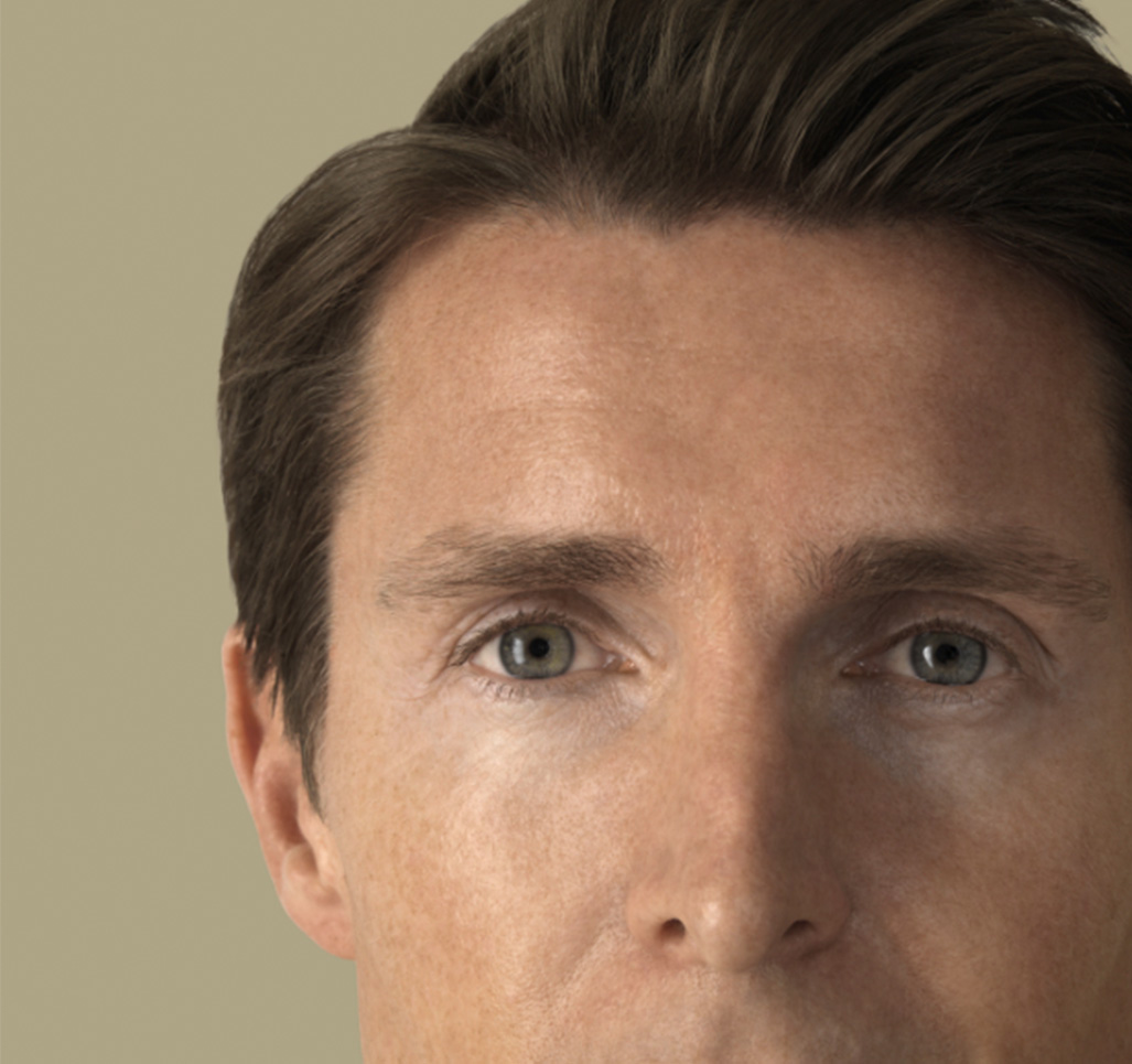 Augenlidstraffung bei einem Mann in Bern