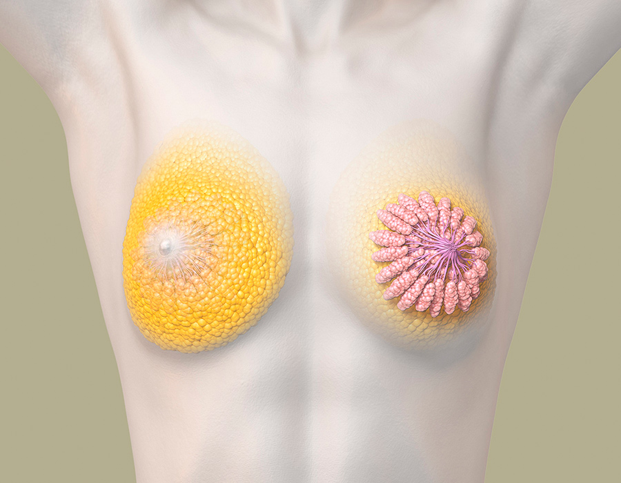 Anatomische Darstellung der weiblichen Brust frontal zur Aufklärung über eine Brustvergrösserung