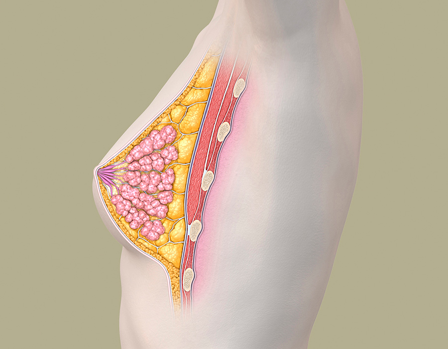 anatomische Darstellung der weiblichen Brust seitlich zur Aufklärung einer Brustvergrösserung