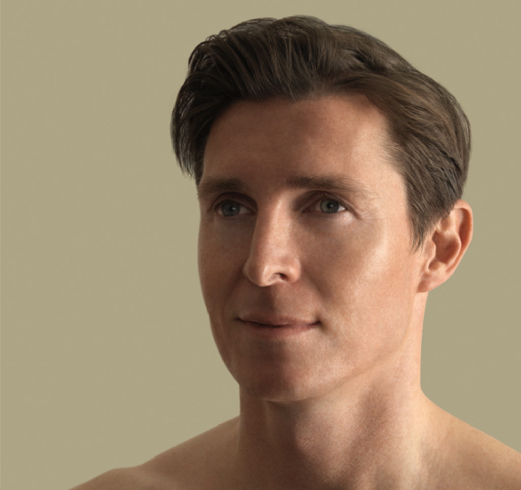 haartransplantation in Bern bei einem Mann